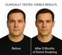 Drema Sculpt™ — The Next Generation of Facial Precision